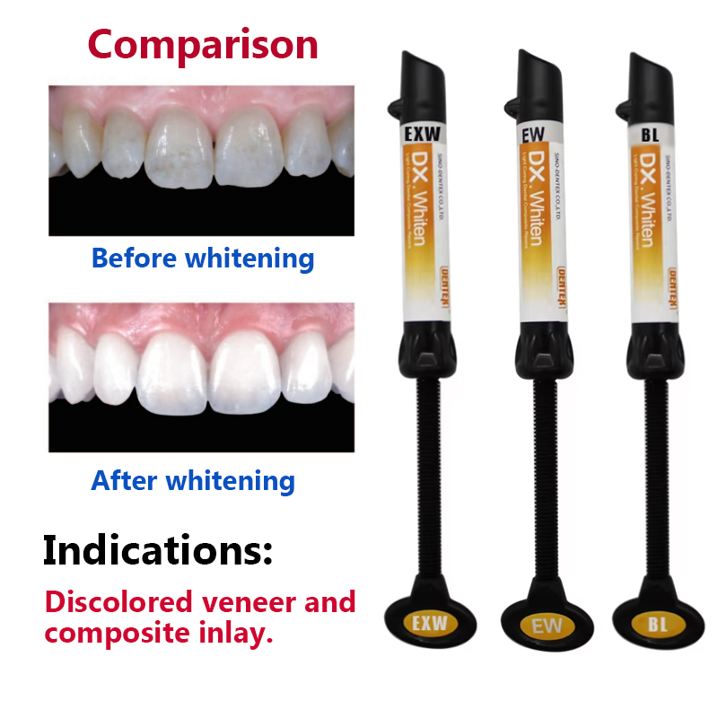 Enamel Light Curing Dental Com - Lighting Jockey recensie en prijs