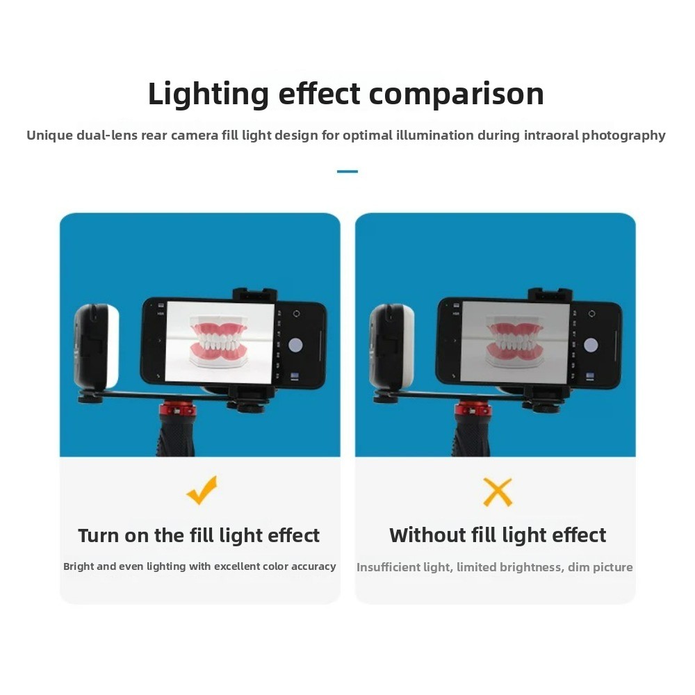 Dental Photography Light, Blue - Lighting Gallery recensie en prijs